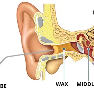 Ear Microsuction Clinic